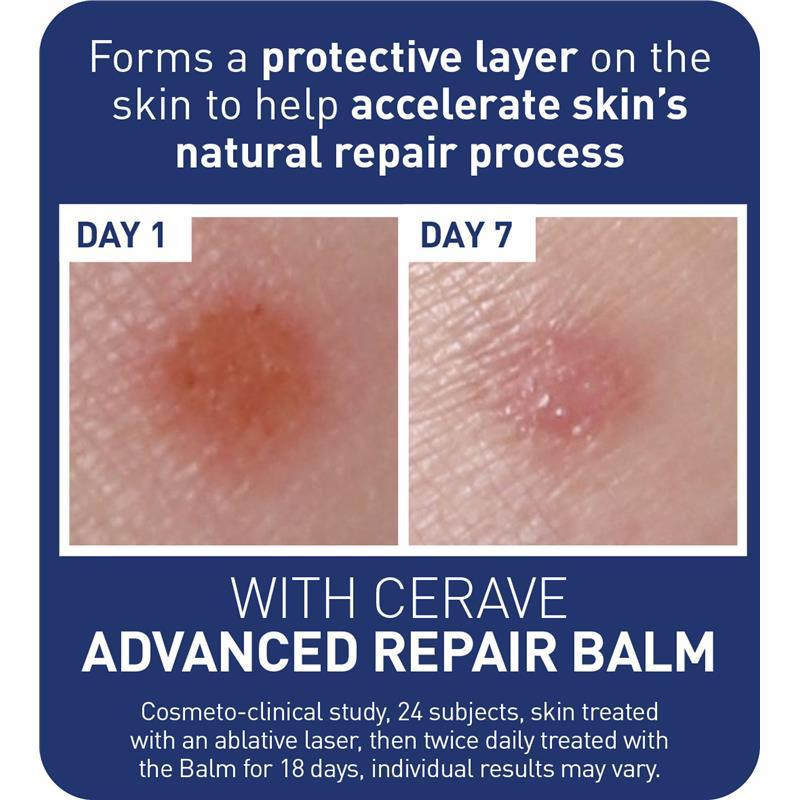 CeraVe Advanced Repair Balm 50ml