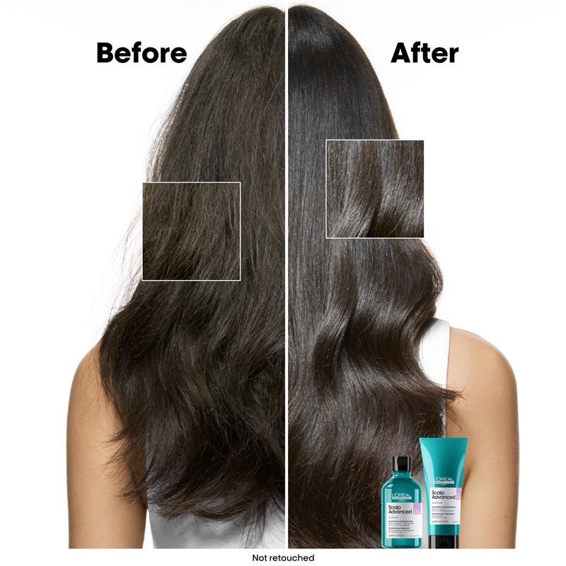 L'Oreal Professionnel Serie Expert Scalp Advanced Anti Discomfort Shampoo 300ml