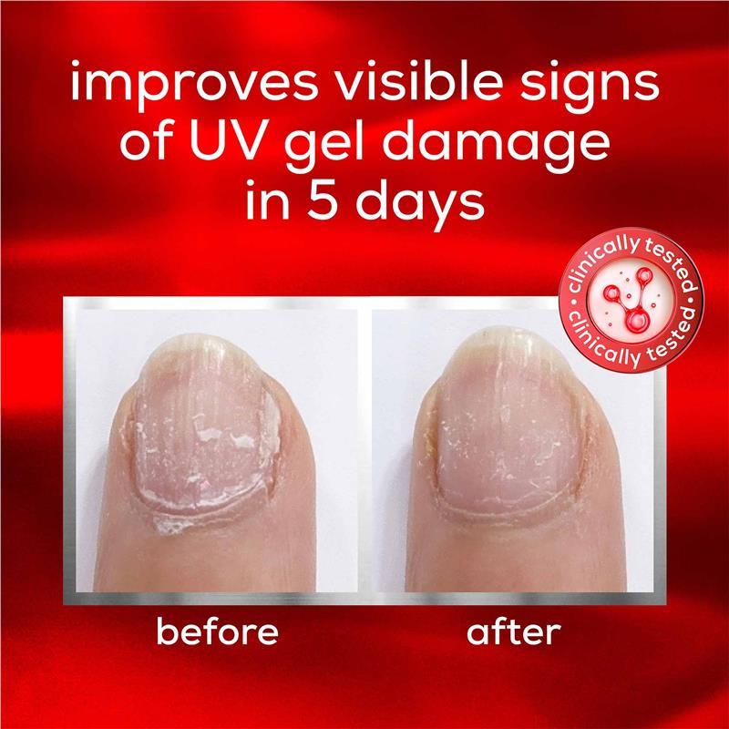 Essie To The Rescue Advanced Nail Treatment