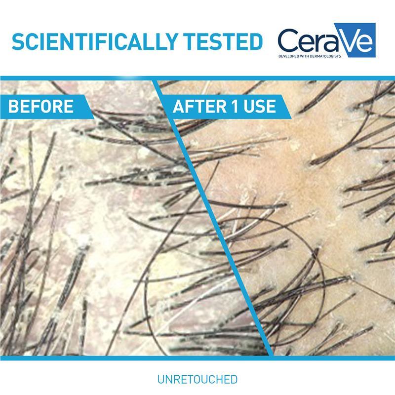 CeraVe Hair Anti-Dandruff Hydrating Conditioner 266ml