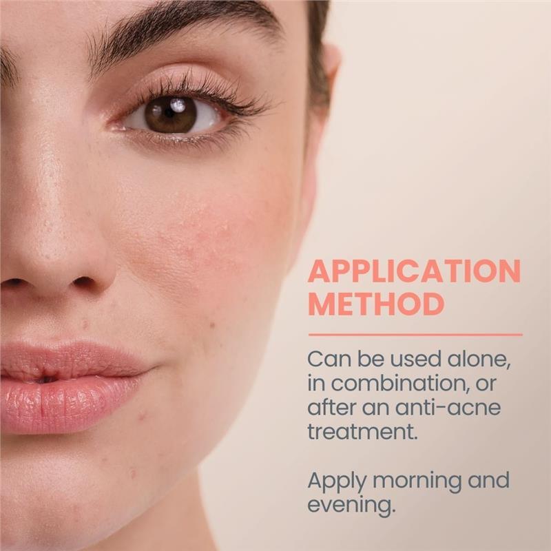 Avene Cleanance Comedomed Anti-Blemishes Concentrate 30ml - Acne moisturiser